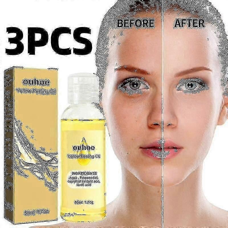 1-3bottle Ouhoe Bright White Exfoliating Oil Deep Cleansing Exfoliating Dead Skin Care Whiten Serum      3bottle 8405750384226