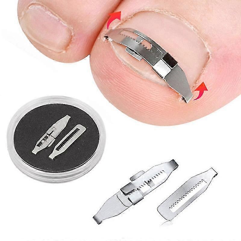 1 Pcs Pedicure Ingrown Toenail Corrector Treatment Tool for Toe Nail Recovery