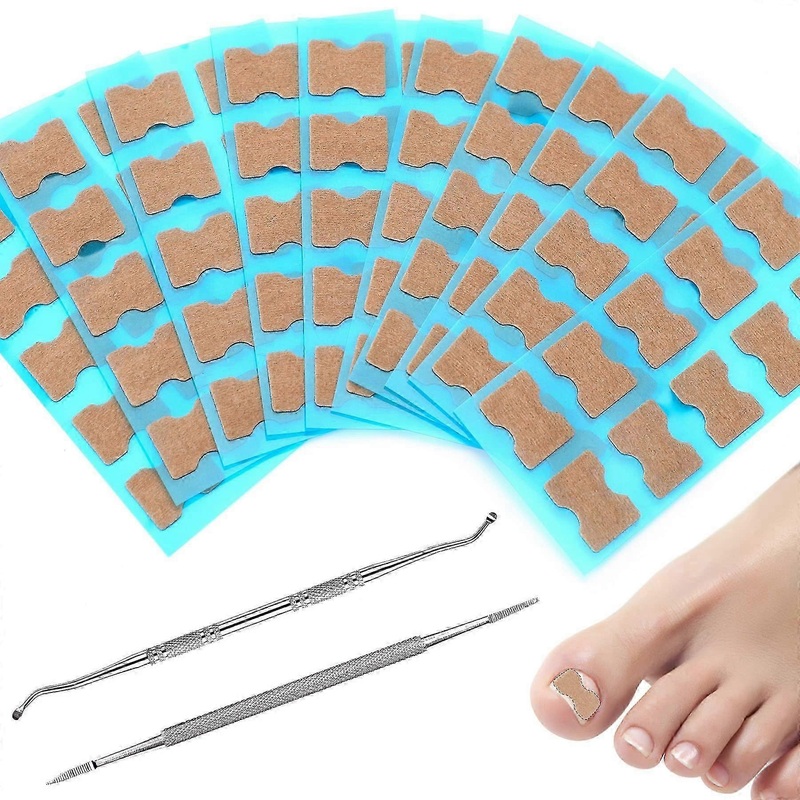100 Pieces Ingrown Toenail Tool Set With 2 Corner Lifters, Foot Care, Toenail Correction, Correction Plasters For Nail Care