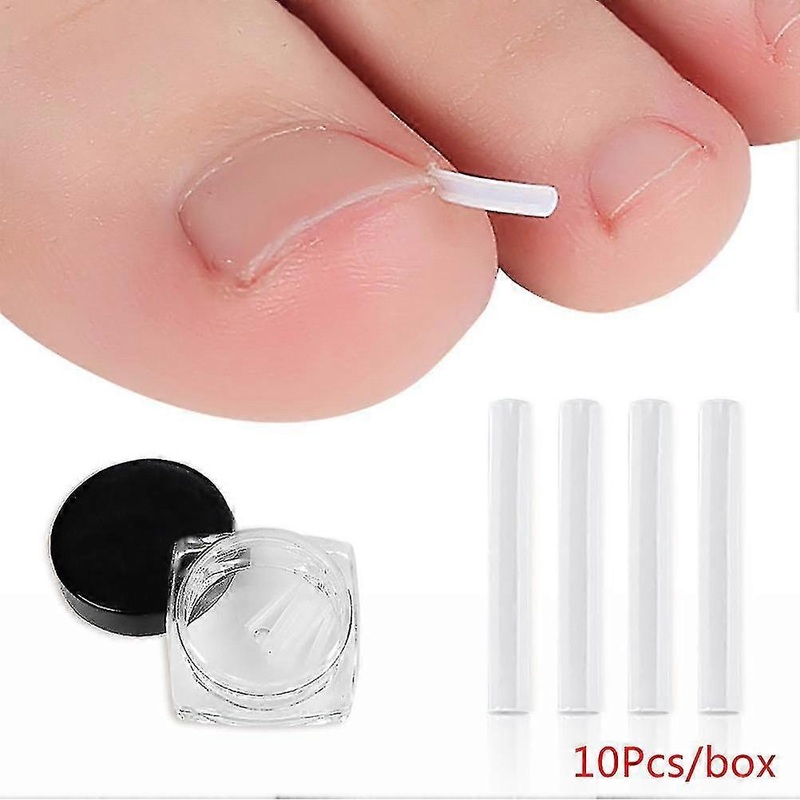 10pcs Toenail Straightening Clip Ingrown Toenail Correction Nail Patch Sticker fo