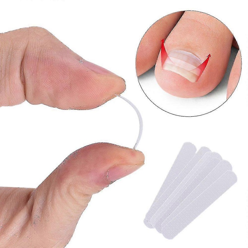 10-Piece Straight and Curved Ingrown Toenail Correction Kit for Thick Paronychia Treatment